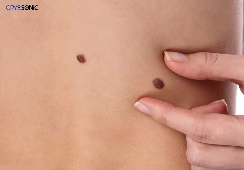 Infection Risk and Poor Aftercare Rickmansworth