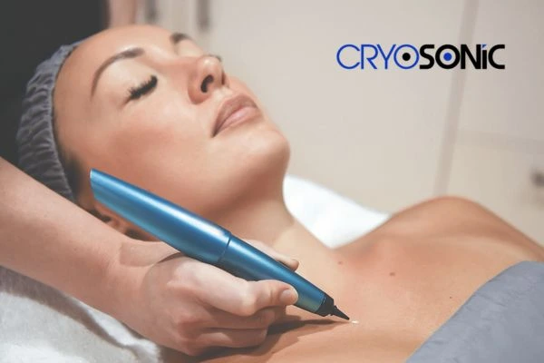 Cryosonic lesion removal prices book today! Rickmansworth
