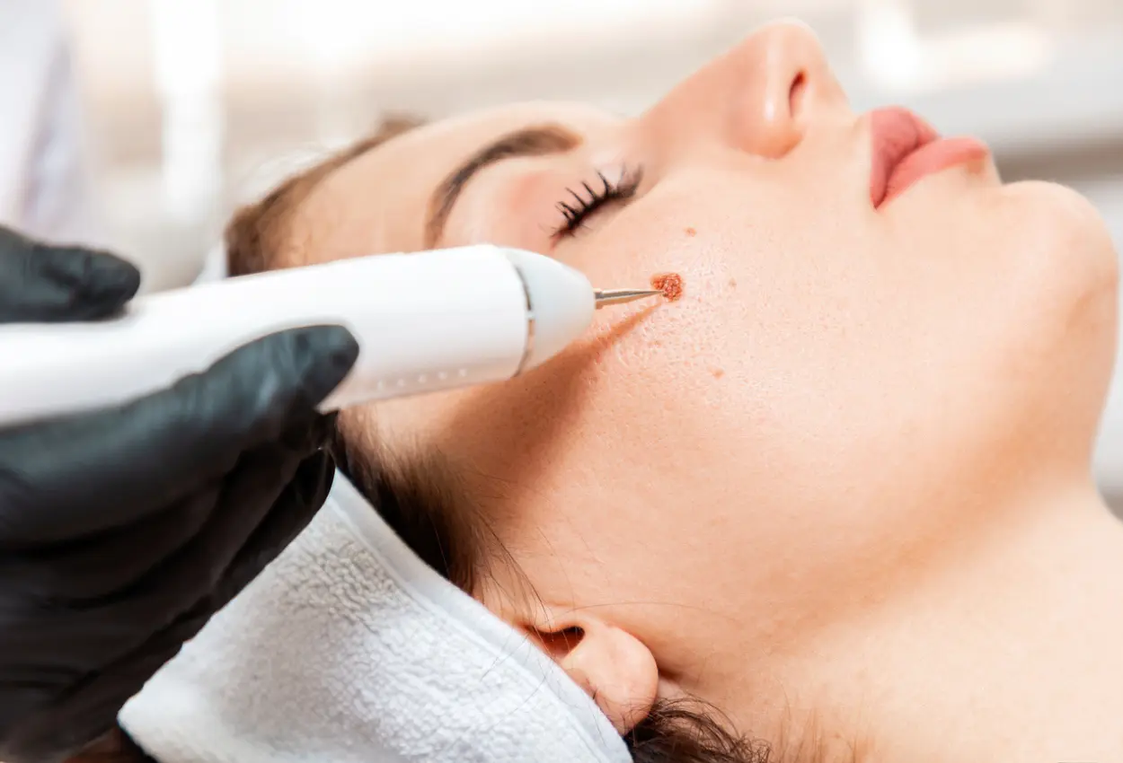 Frequently Asked Questions About Multiple Cryotherapy Treatments Rickmansworth