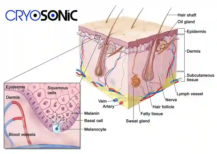How Cryotherapy Stimulates Melanocyte Activity  Rickmansworth